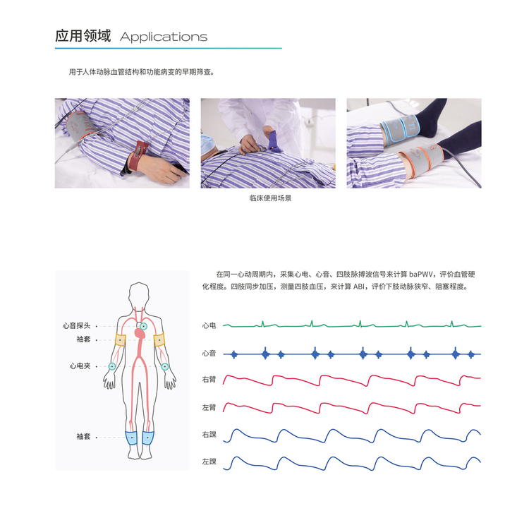 動脈硬化檢測儀應用領(lǐng)域