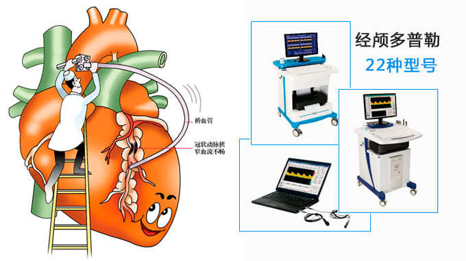 心肌梗死呵護_經顱多普勒_tcd檢查.jpg